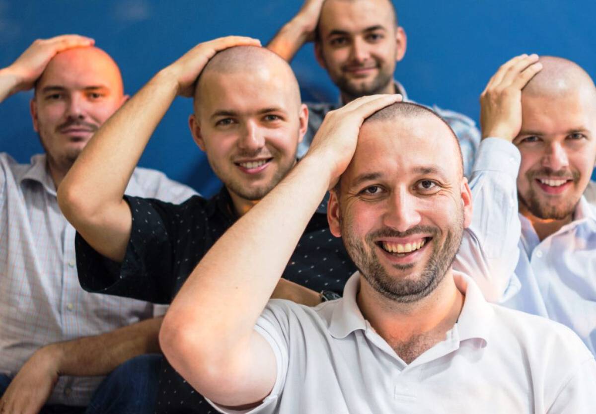 La última de la ciencia: ¿masturbarte te deja calvo?