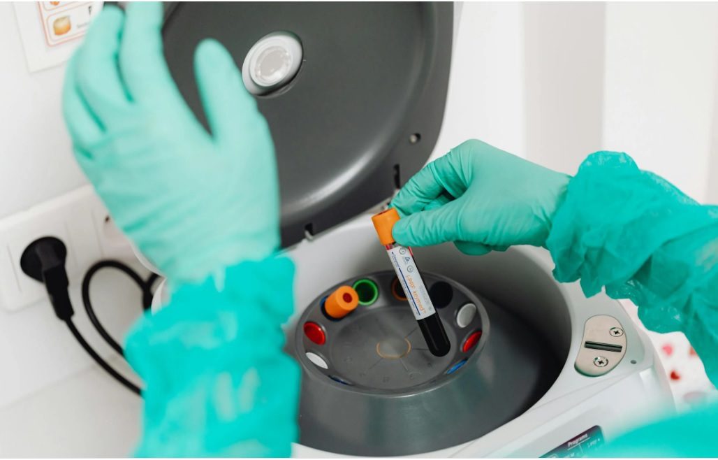 ACCES LA ANALIZE DECONTATE, ÎNTREAGA LUNĂ