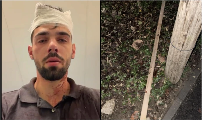 Bătut în Complexul Studențesc și trimis la spital Bătut în Complexul Studențesc și trimis la spital