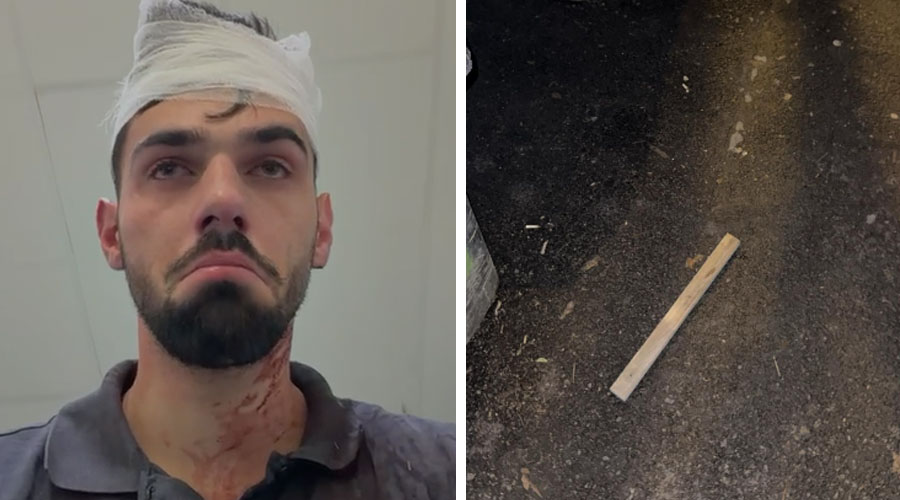 Bătaie cu pari, în Complexul Studențesc! Fotbaliști de la Poli, acuzați că au bătut cu bestialitate, un tânăr de 19 ani